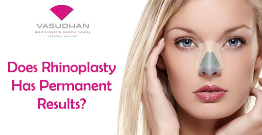 Does Rhinoplasty Has Permanent Results?