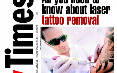 All you need to know about laser tattoo removal