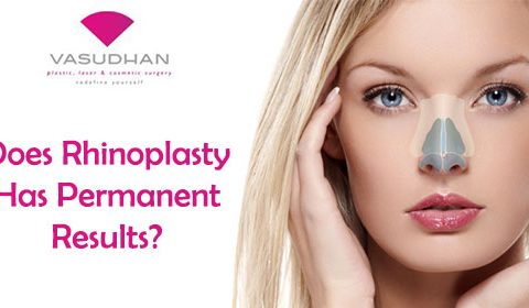 Does Rhinoplasty Has Permanent Results?
