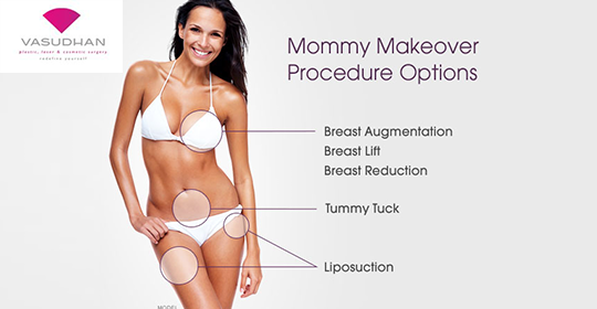 Why Mommy Makeover Recommended After Pregnancy